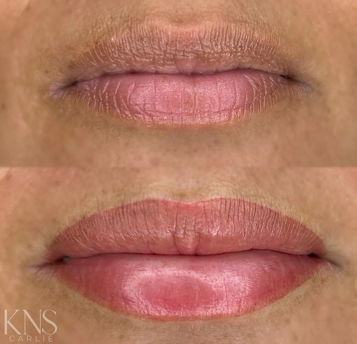 Lip blushing before-and-after with defined Cupid's bow peaks on sun-kissed skin — healed results at Kendra Neal Studio