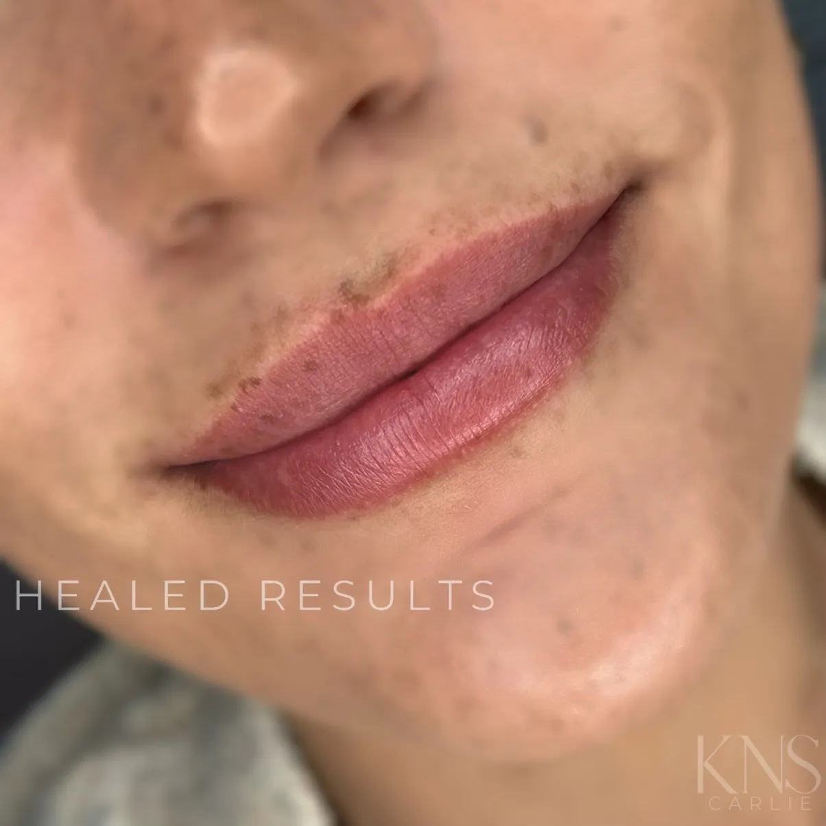 Lip blushing healed result, close-up angled view — Kendra Neal Studio