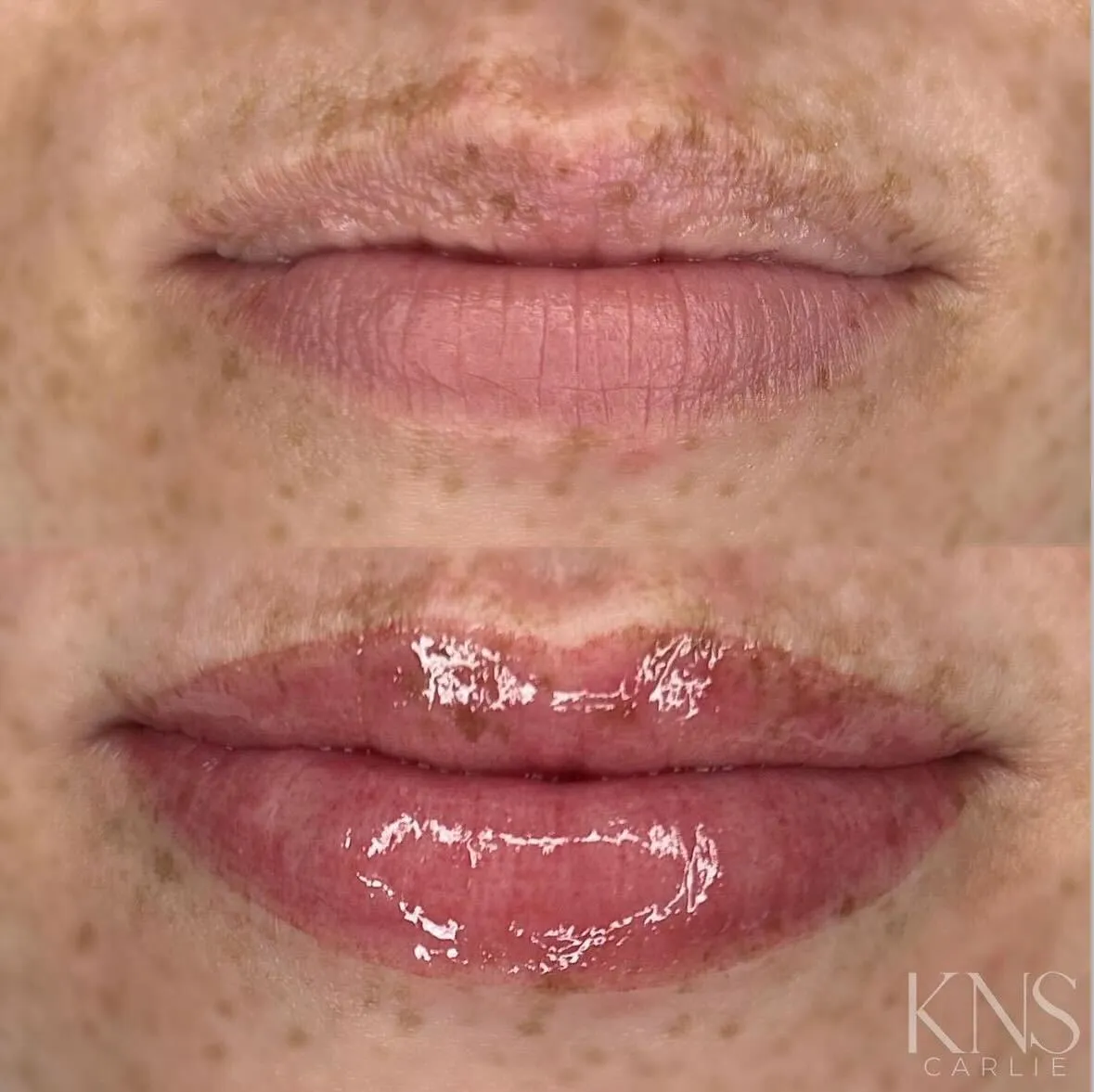 Lip blushing before-and-after on freckled skin — healed results at Kendra Neal Studio