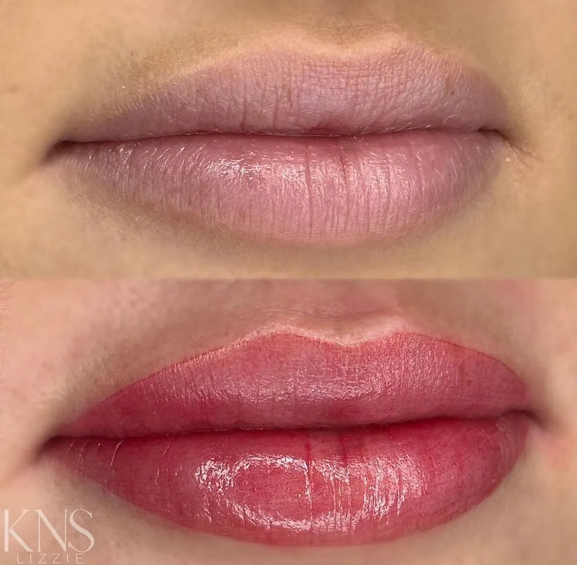 Lip neutralization and blushing before-and-after for a dark, uneven undertone — healed results at Kendra Neal Studio