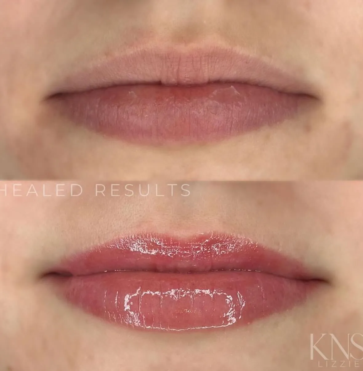 Lip blushing before-and-after for pale lips — healed results at Kendra Neal Studio