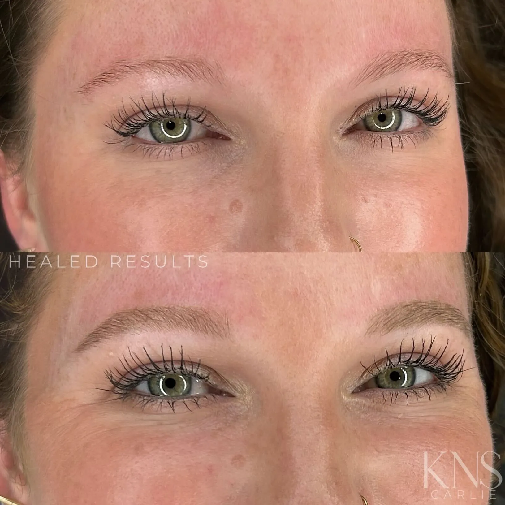 Nanobrow before-and-after on a redhead with rosacea-prone skin — healed results at Kendra Neal Studio