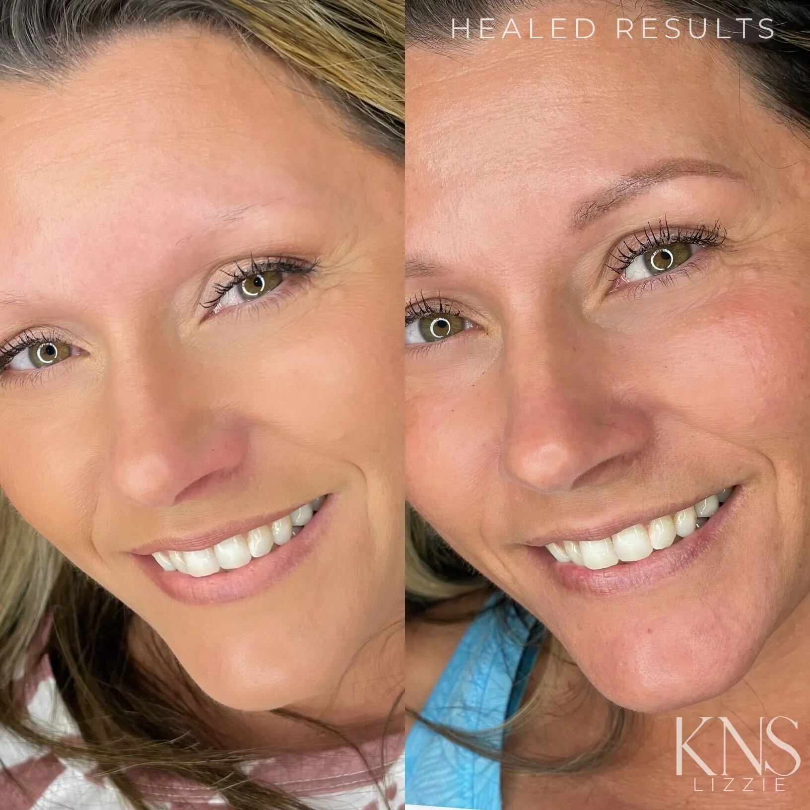 Nanobrow before-and-after for very light, faded eyebrows — healed results at Kendra Neal Studio
