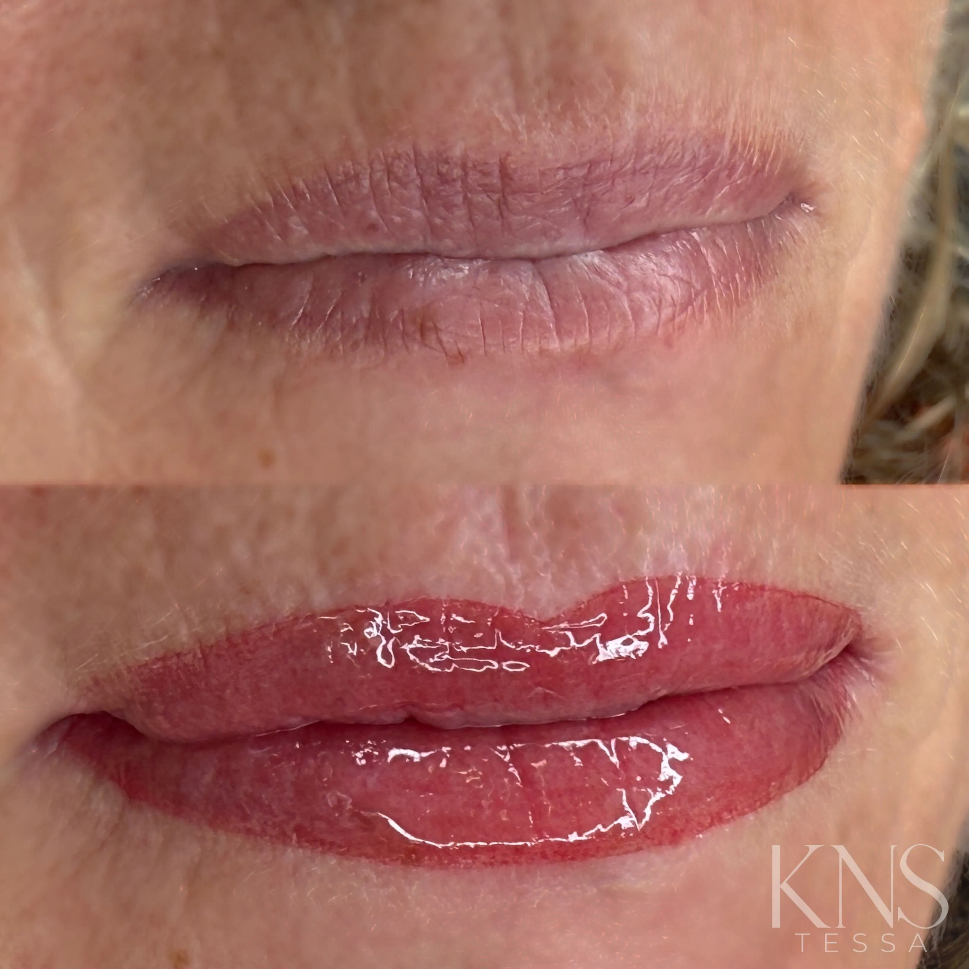 Lip neutralization and blushing before-and-after for a dark, uneven undertone — healed results at Kendra Neal Studio
