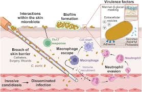 https://www.researchgate.net/publication/376744856/figure/fig1/AS%3A11431281276628132%401725693621036/Candida-auris-mechanisms-of-pathogenesis-C-auris-colonizes-and-persists-on-the-skin-and.tif