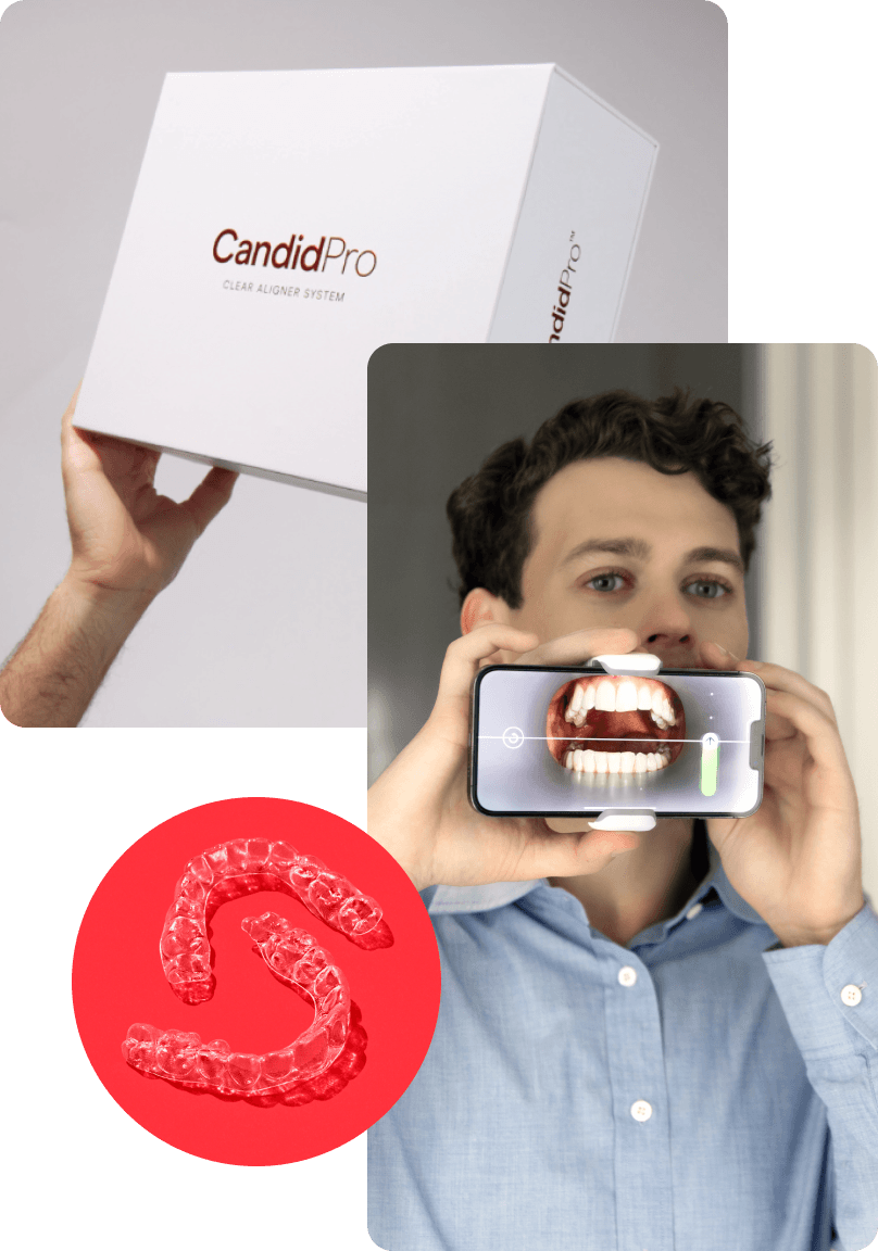 Included in CandidPro
