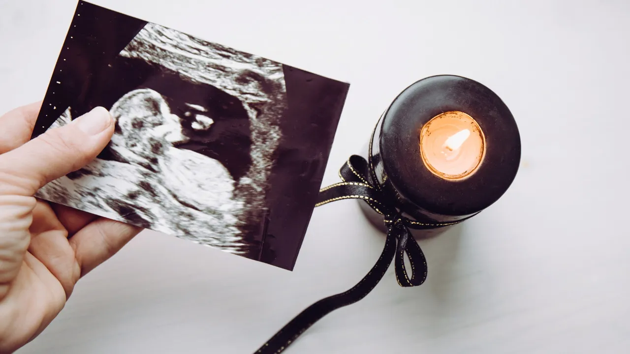 Наблюдение беременности