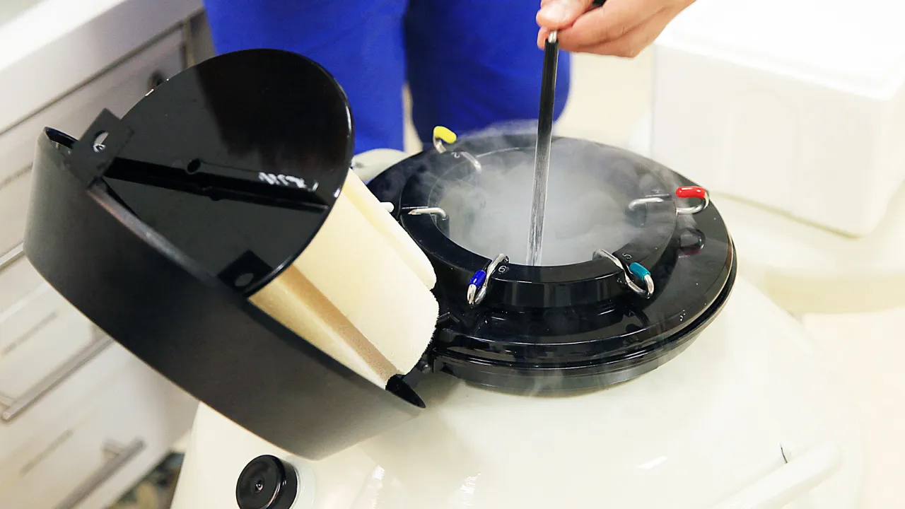 Заморозка донорских ооцитов