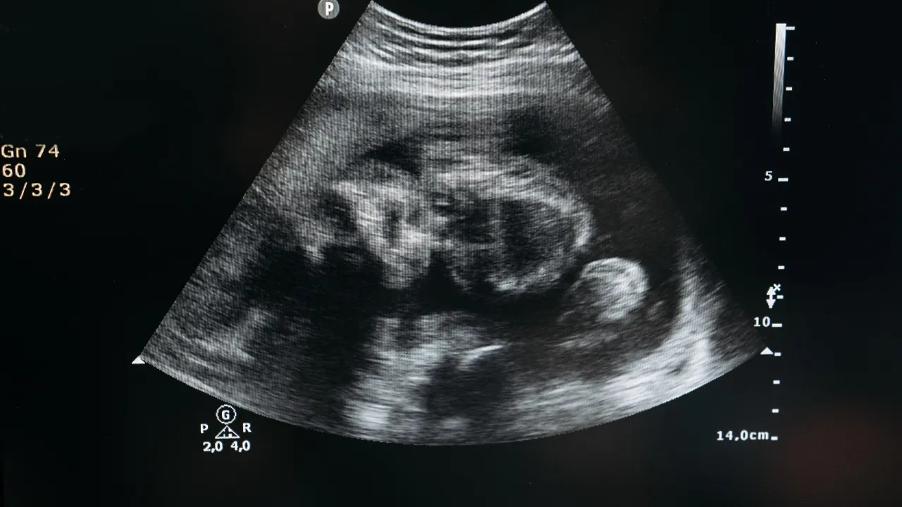 Может ли одинокий мужчина использовать суррогатное материнство