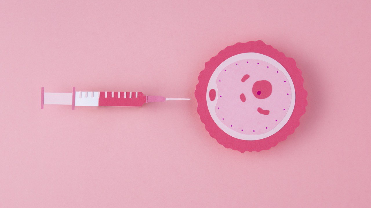 Лечение синдрома пустых фолликулов