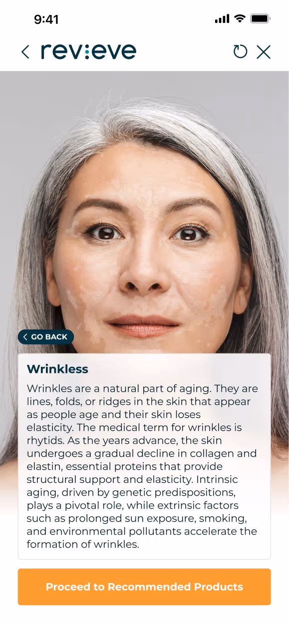 Close-up of a mature woman with gray hair and smooth skin on an app screen explaining wrinkles, their causes, and aging effects.