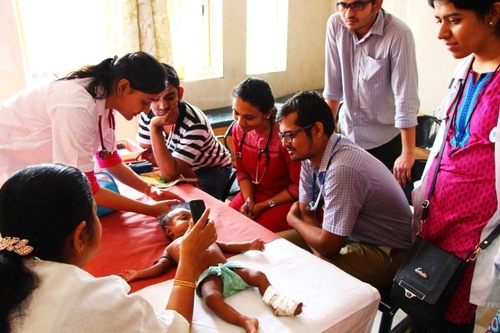 Feebris in use in India helping diagnose children