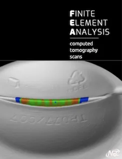 Computed tomography scan depicting finite element analysis