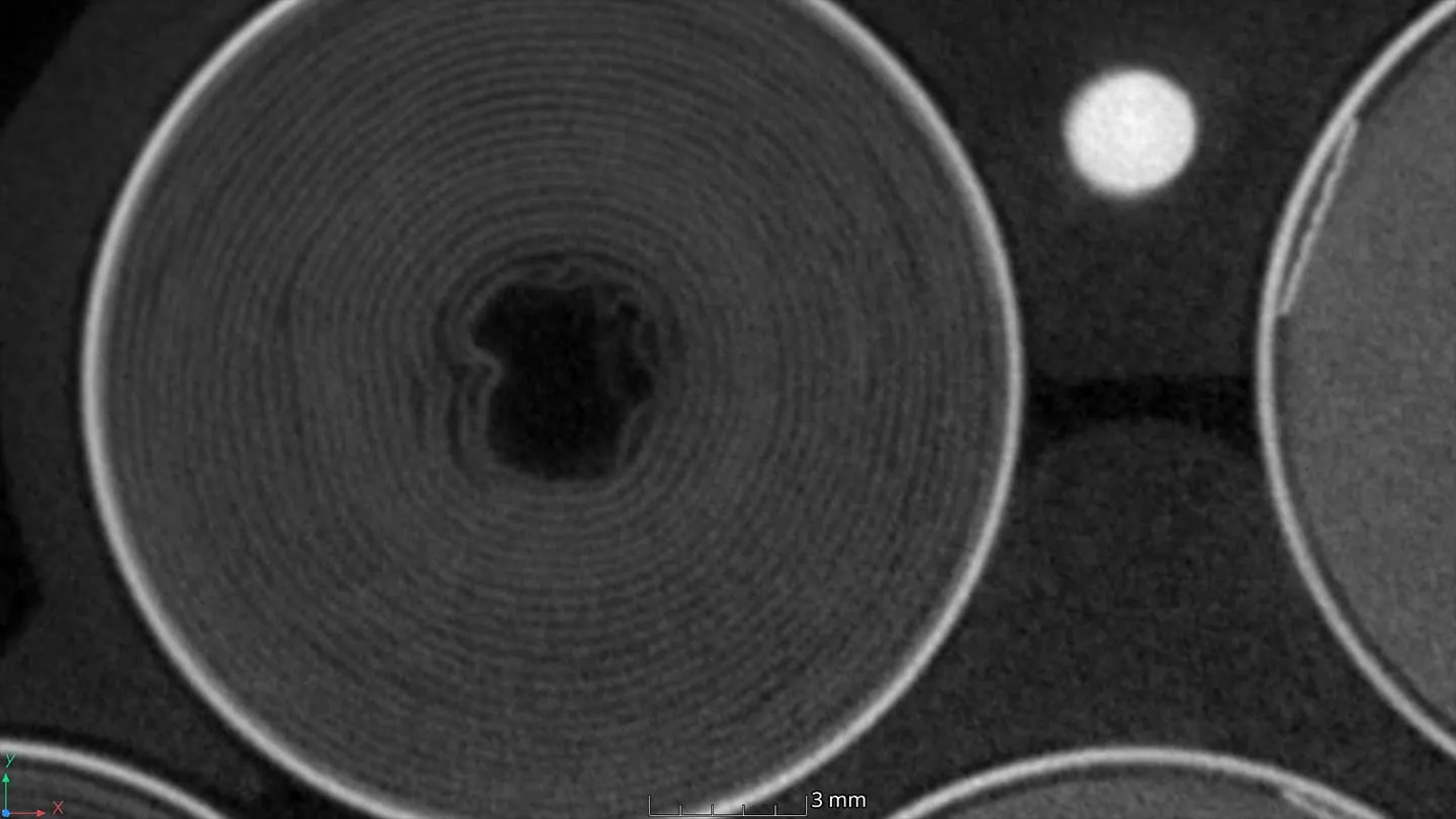 2D CT scan battery pack