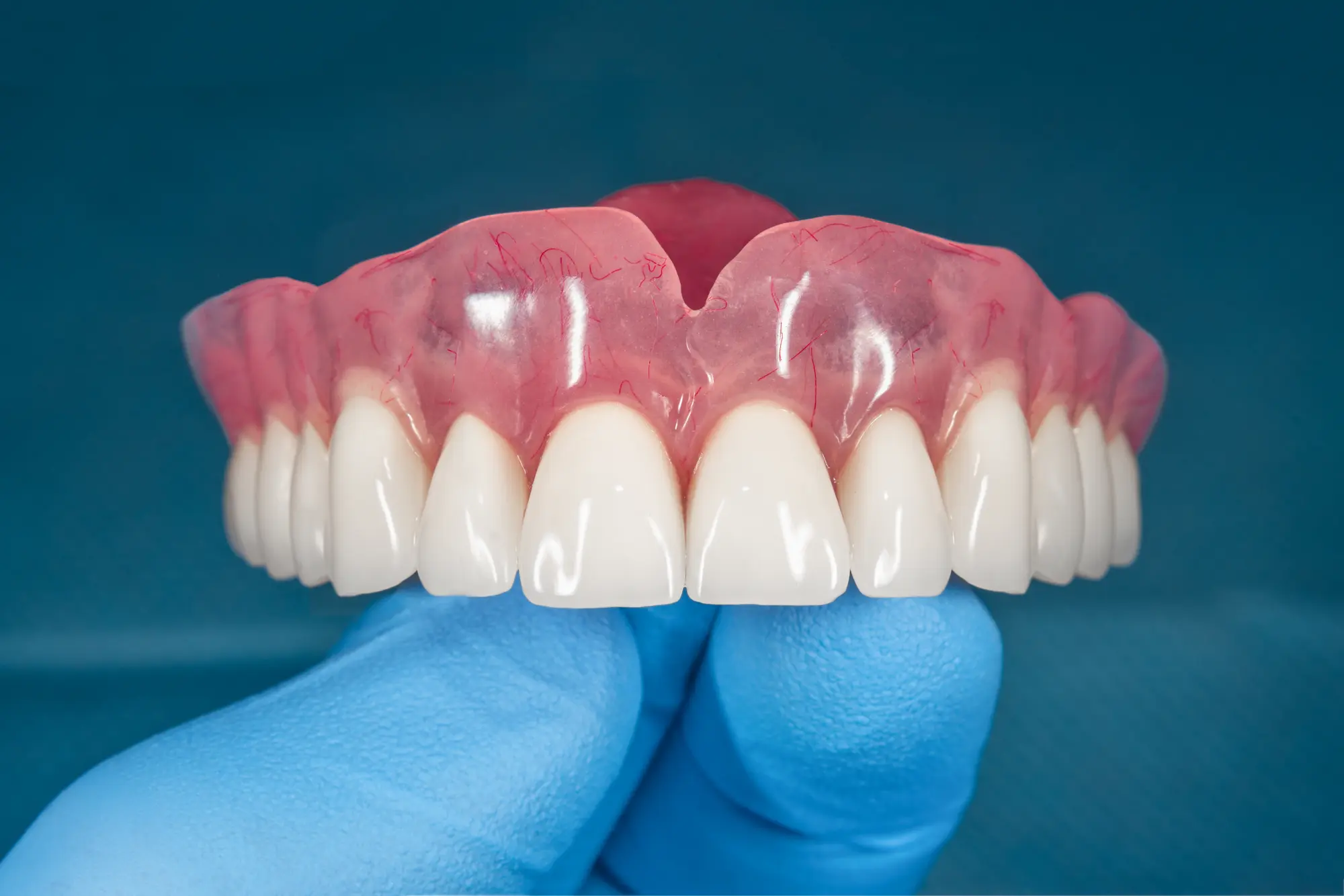 How to Care for Your Dentures: Tips from a Spartanburg Dentist