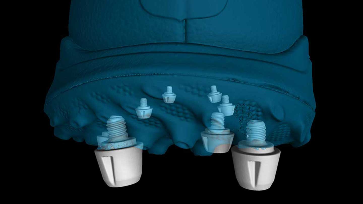 Nex-Gen Engineer Uses CT Scanning to Re-Design Sports Equipment