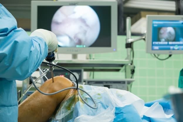 Atlanta Knee Arthroscopy