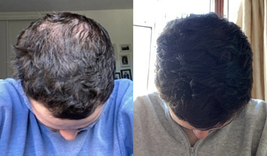 Michael-before-after