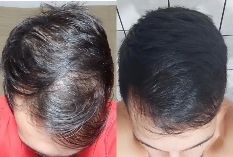 Cleandho before-after