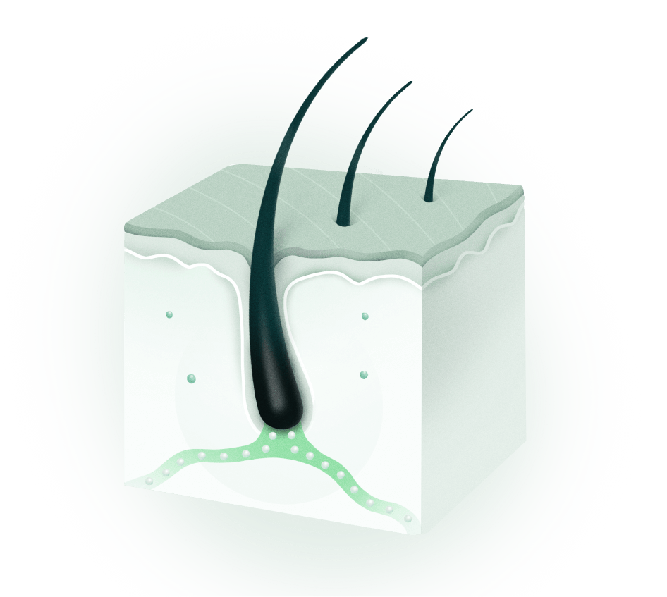 M - Minoxidil activates hair follicles