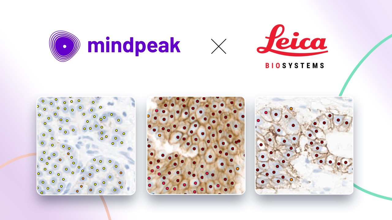 Mindpeak Announces Global Reseller Agreement with Leica Biosystems 