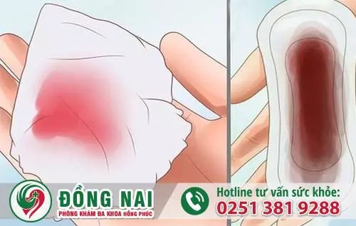Kinh nguyệt có màu bất thường