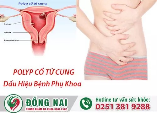 Bệnh cổ tử cung là gì?
