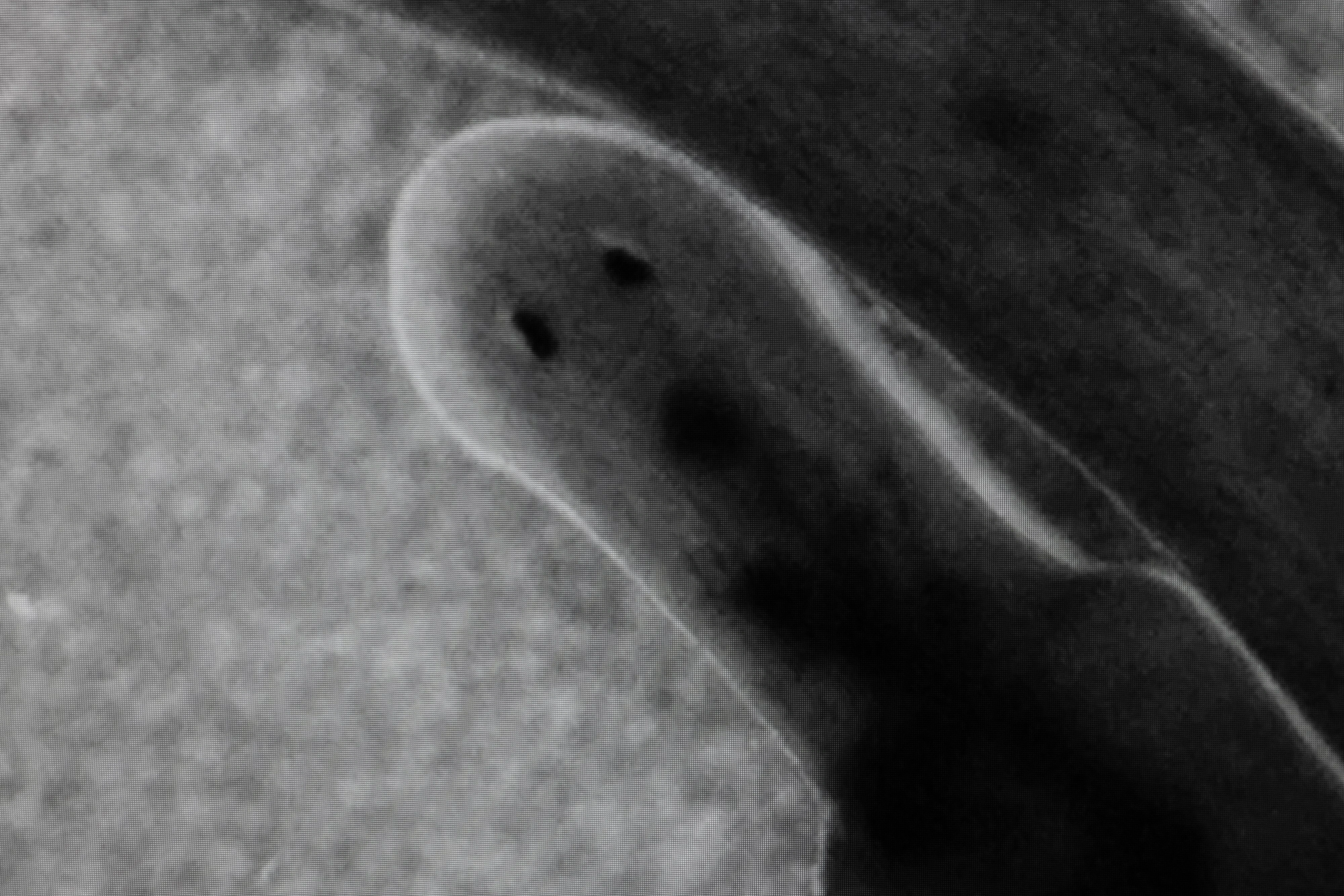 Close-up planarian worm head under microscope, rounded ghost-like form with two small eye-spots, regenerative biology research, Strange Rules, Palazzo Diedo