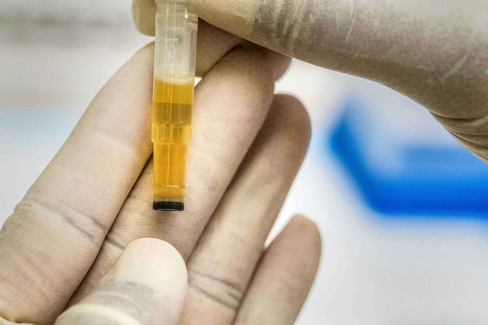 How Long Does Alcohol Stay in Your Urine and Affect Testing?