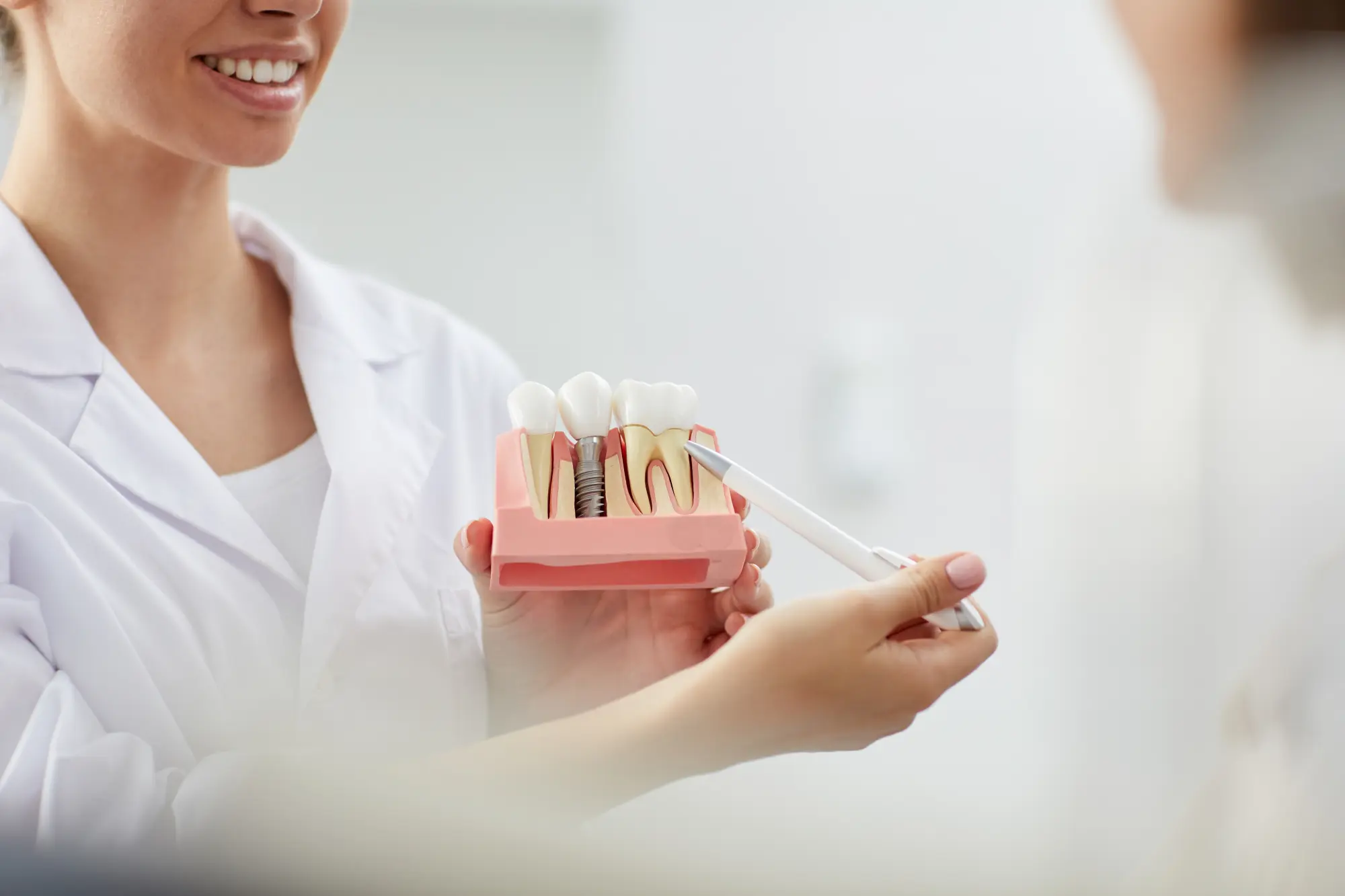 Dental Implants: The Permanent Solution for Missing Teeth in Middle Tennessee