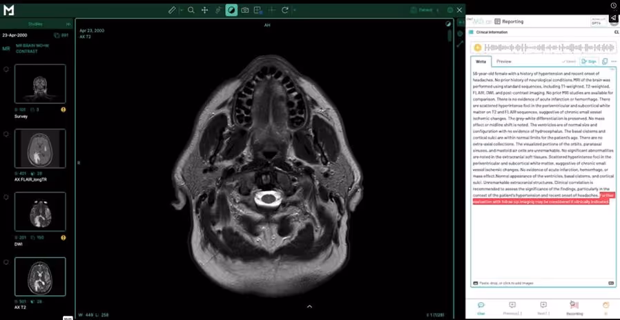 structured reporting for radiology