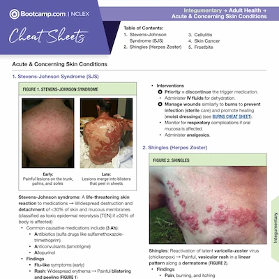 Educational NCLEX cheat sheet showing acute skin conditions: Stevens-Johnson Syndrome with photo of painful skin lesions and care interventions, and Shingles with photo of red blistered rash on skin.