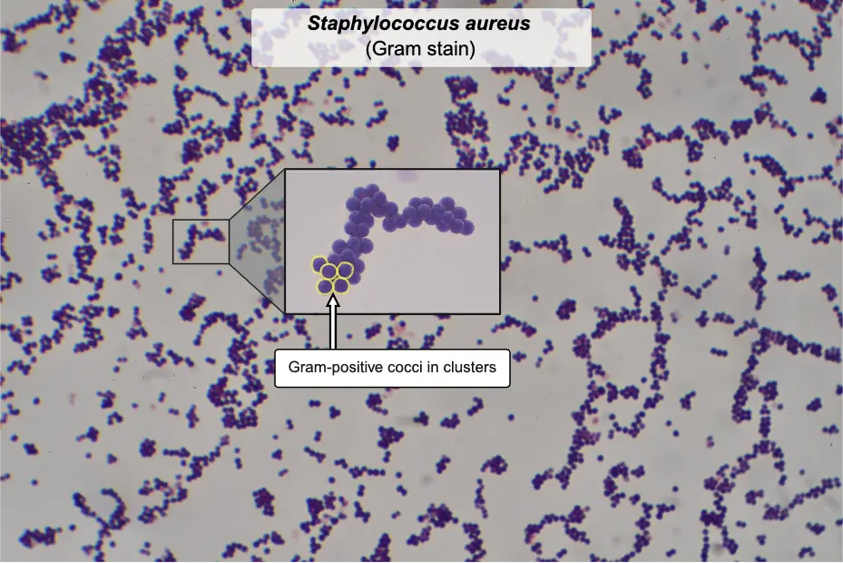 Staphylococcus aureus labeled