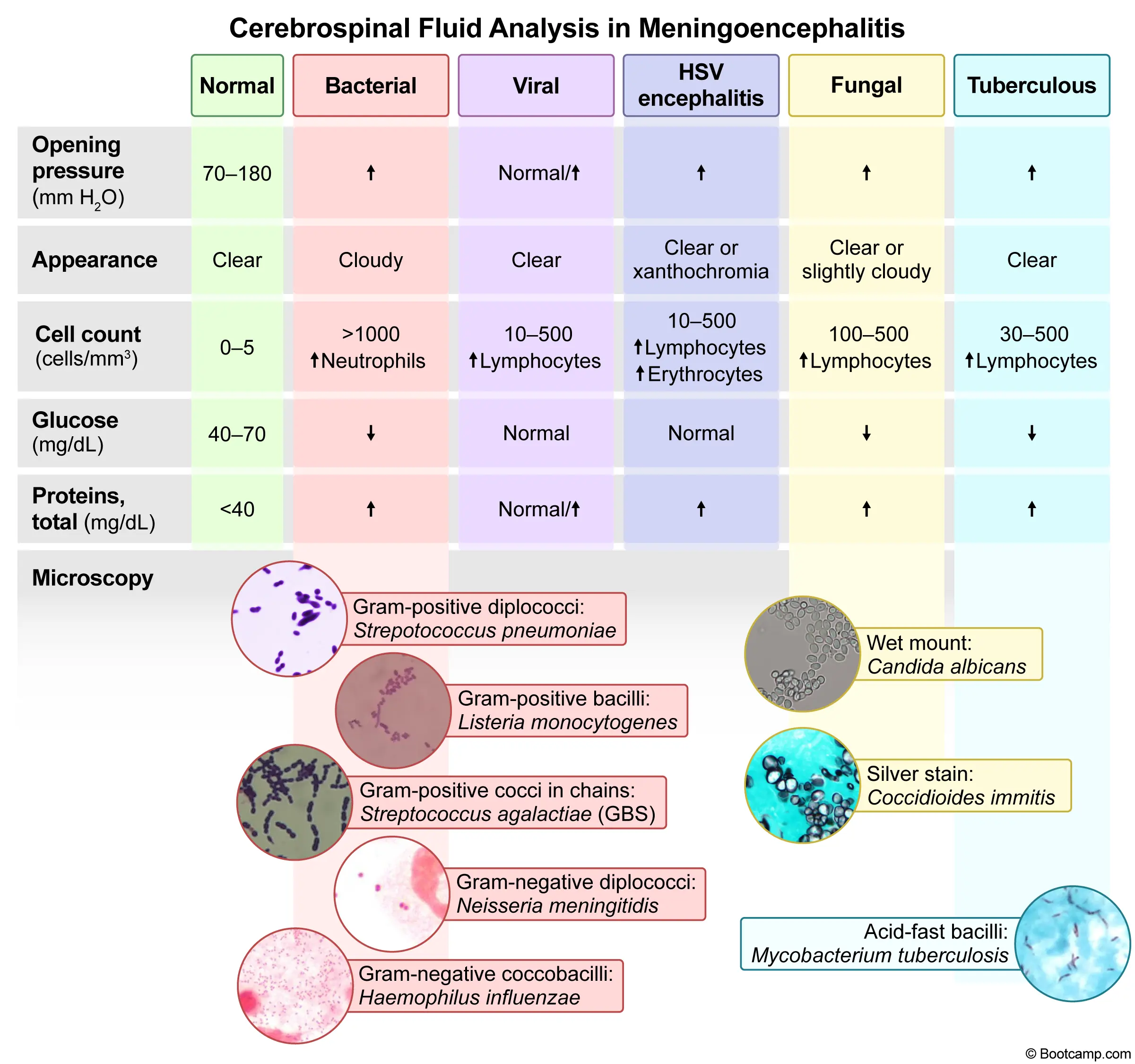 Cerebrospinal Fluid Analysis in Meningoencephalitis