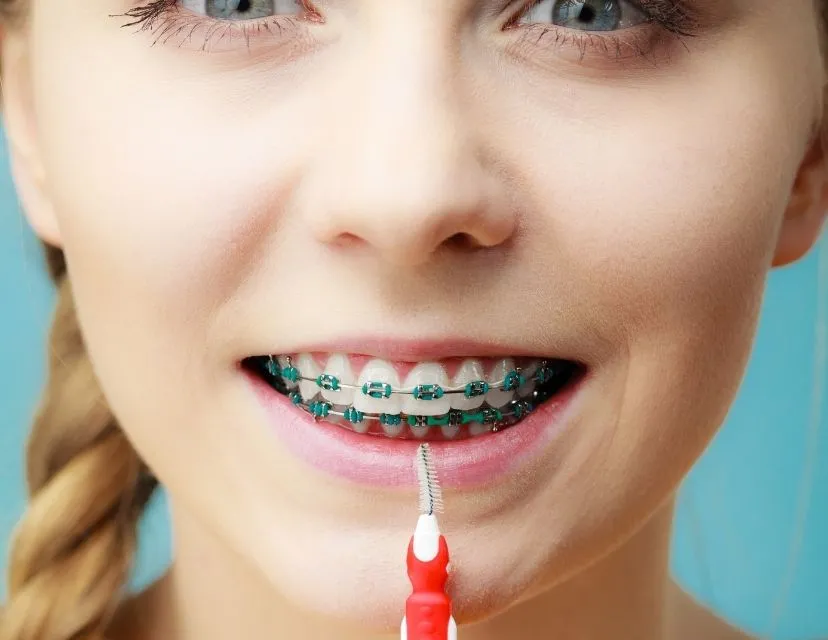 Women with braces smiling
