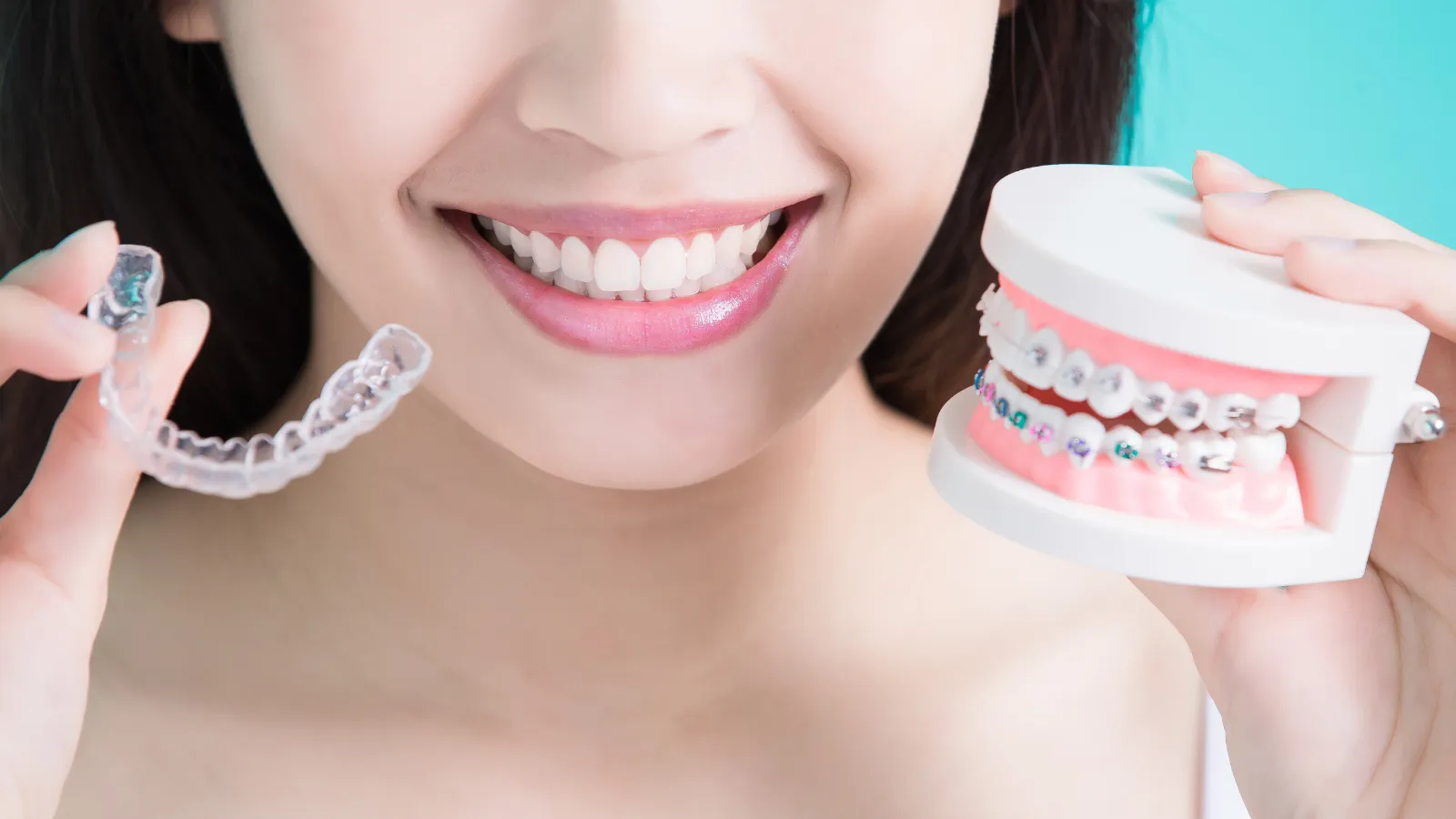Women smiling holding several retainers