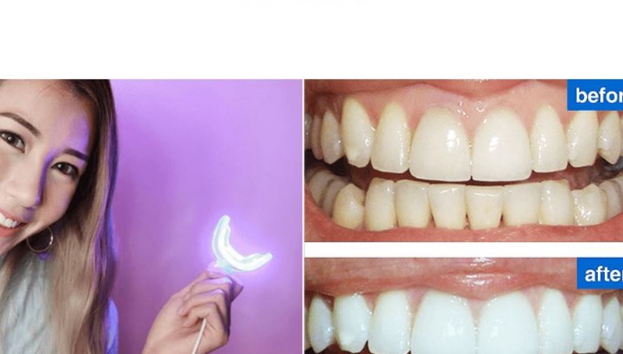 Precauții când utilizați Oral Care Pro?