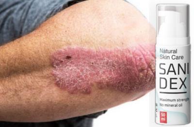 Sanidex krém na léčbu psoriázy, složení, fórum, Česká Republika