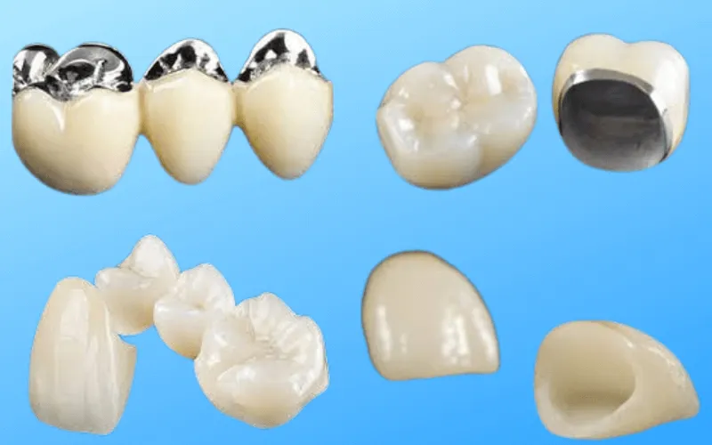 zobne krone primadent