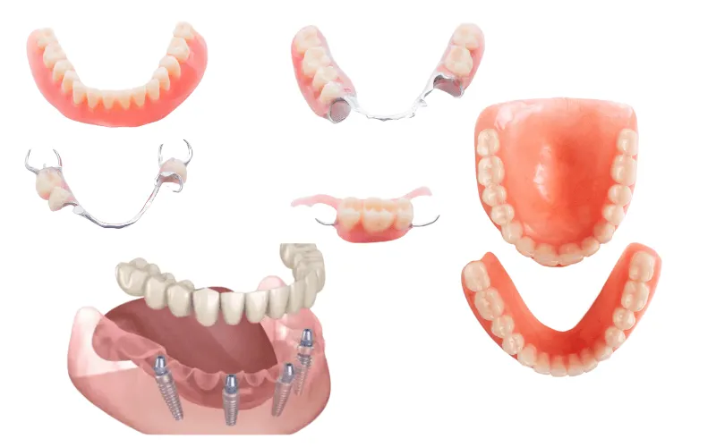 Zobne proteze Primadent