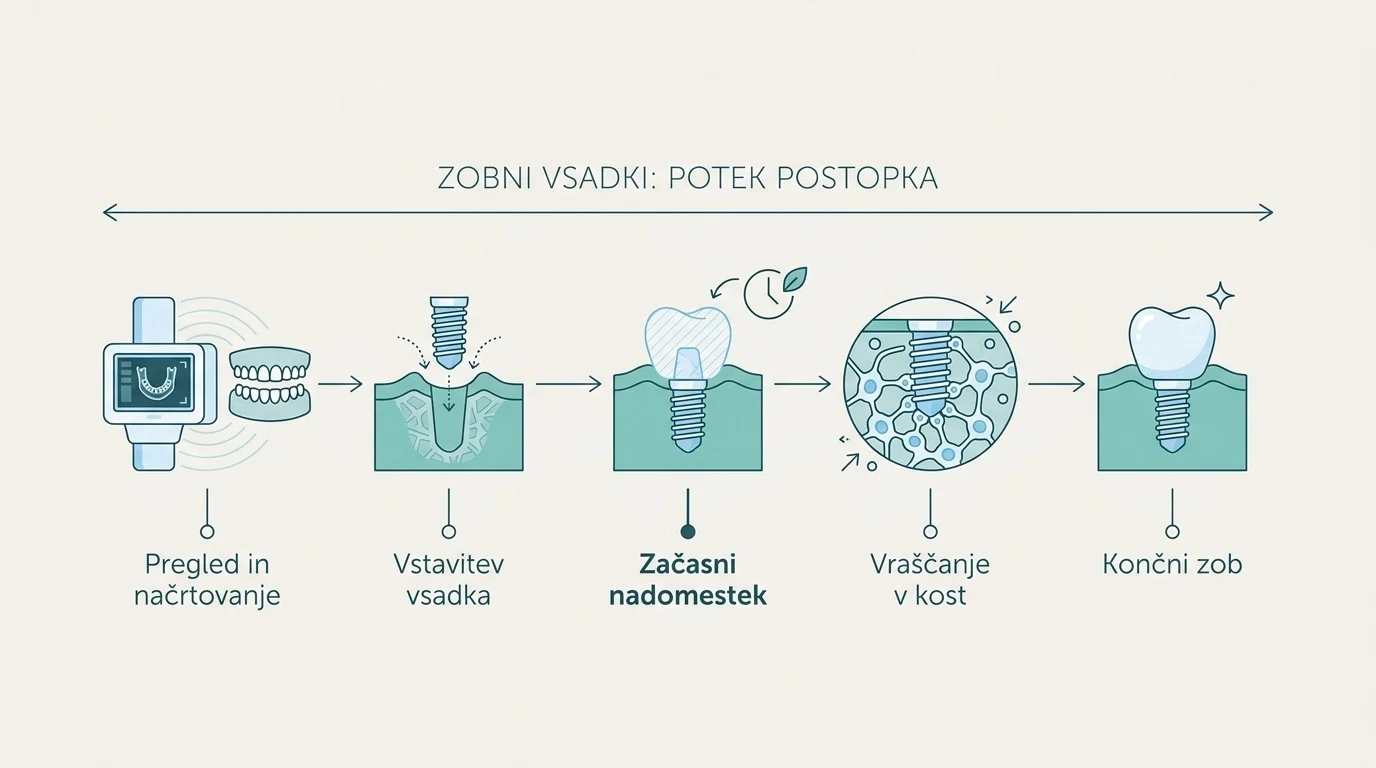 Shematski prikaz korakov do zobnega vsadka, od prvega pregleda in začasnega zoba med celjenjem do namestitve končne krone.