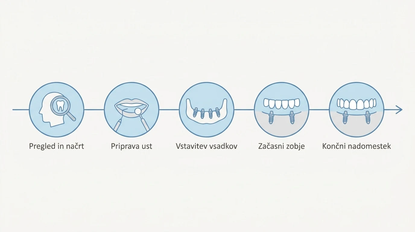 Shematski prikaz petih korakov postopka All-on-4 od prvega pregleda do končnega fiksnega zobnega loka.
