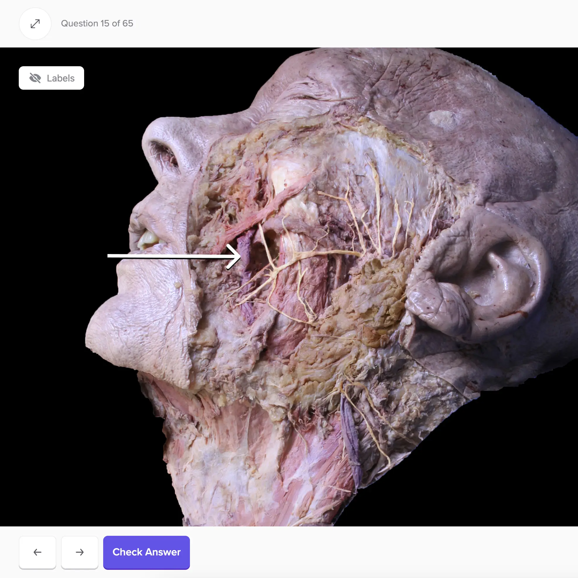 Identify structures on real-life cadaveric images