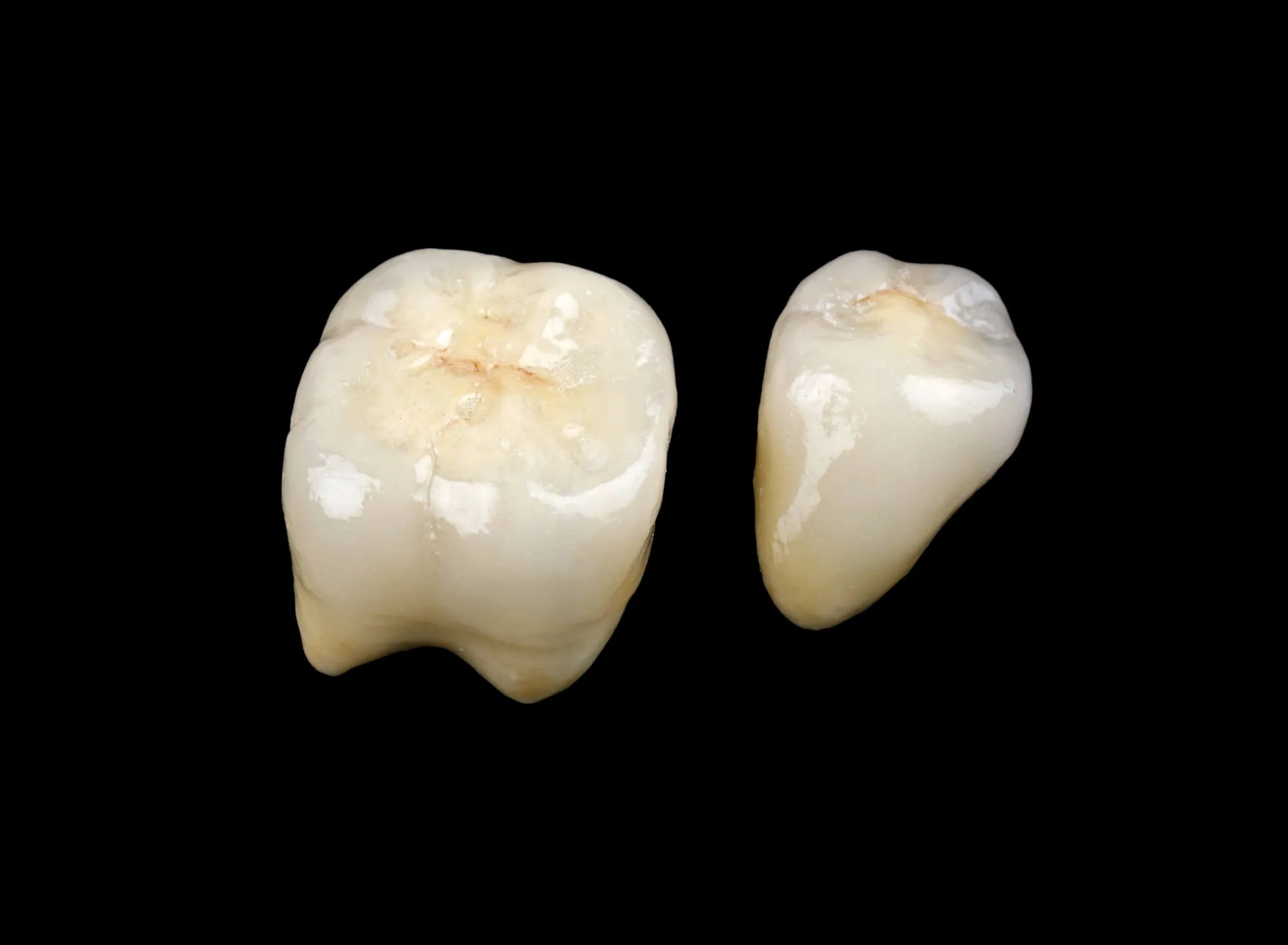Dental Crowns Candler NC on black background