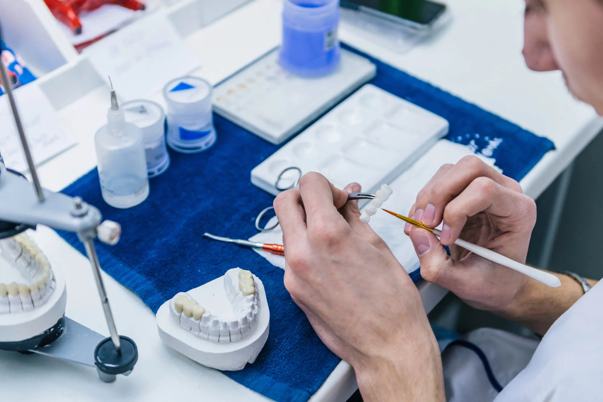 fabricating Dental Bridges Candler NC
