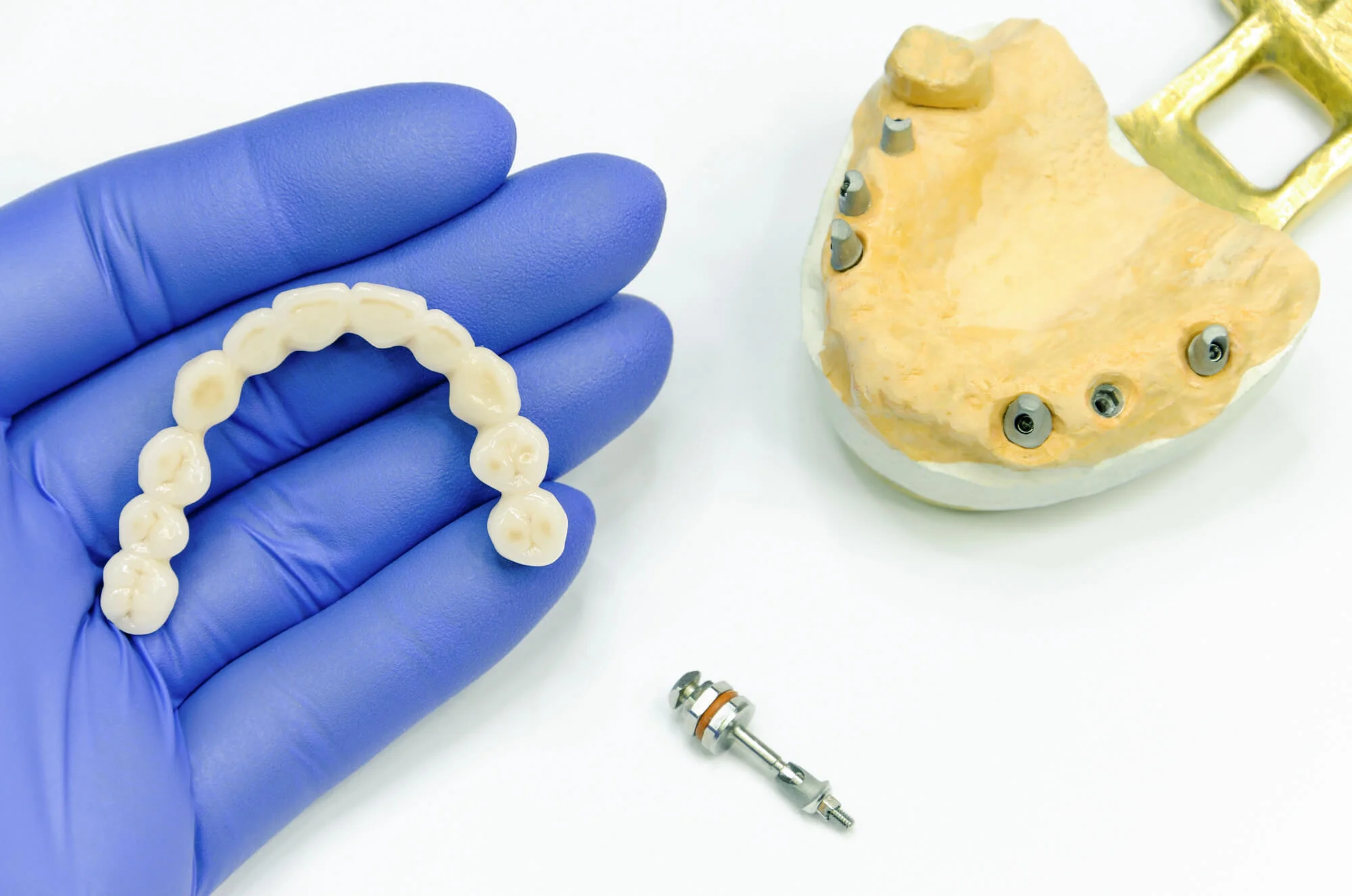 bridge in hand dental bridges in Candler, NC