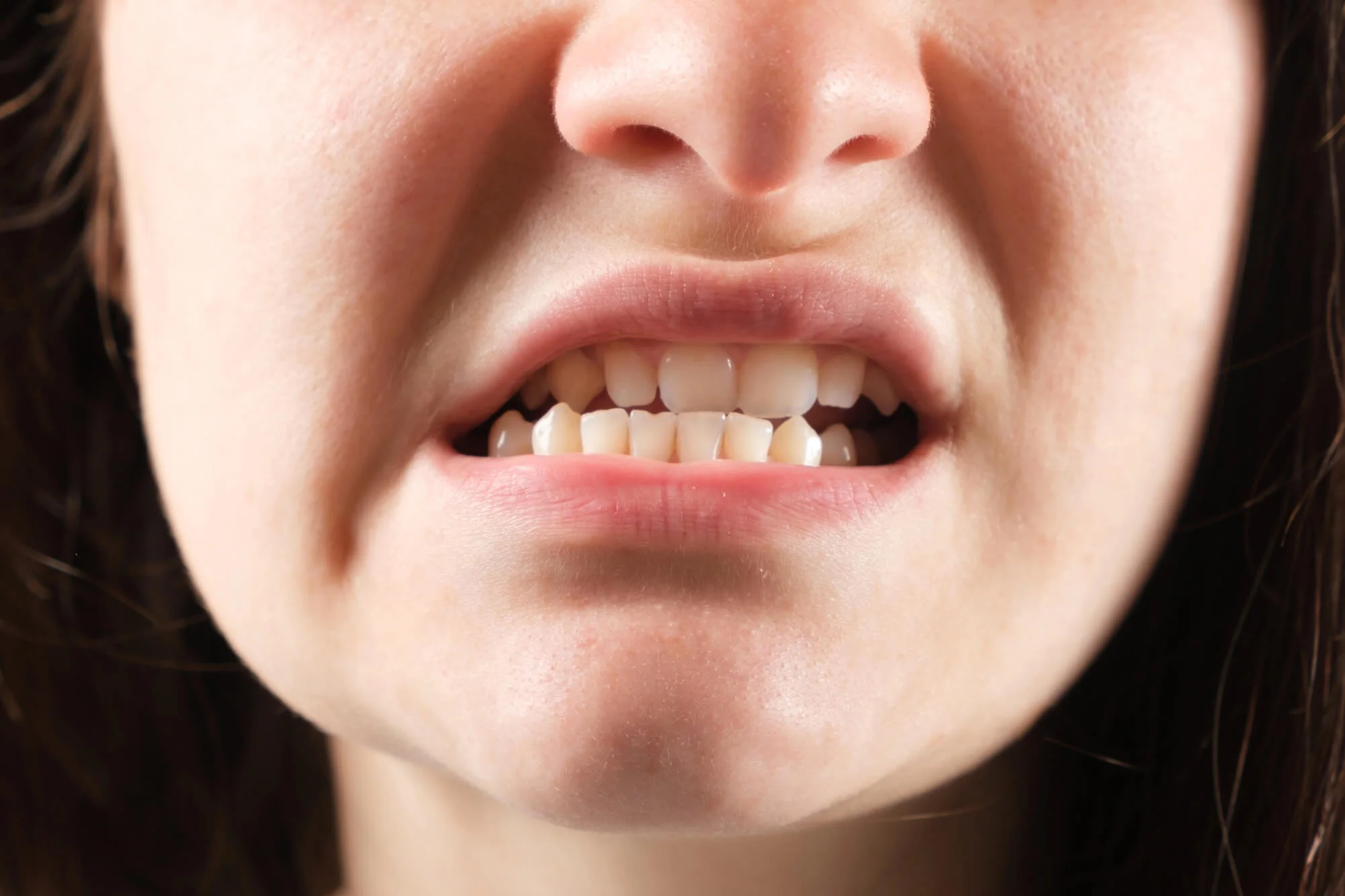 Person with jaw tension and pain – TMD in Franklin
