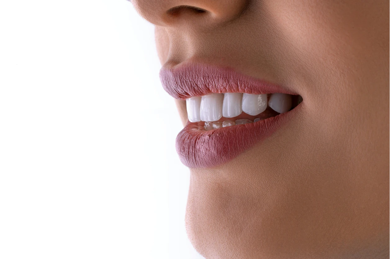 Experienced dental hygienists providing gentle cleanings in San Diego