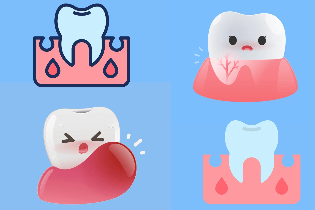 Icon showing pediatric gum issues and gum inflammation.