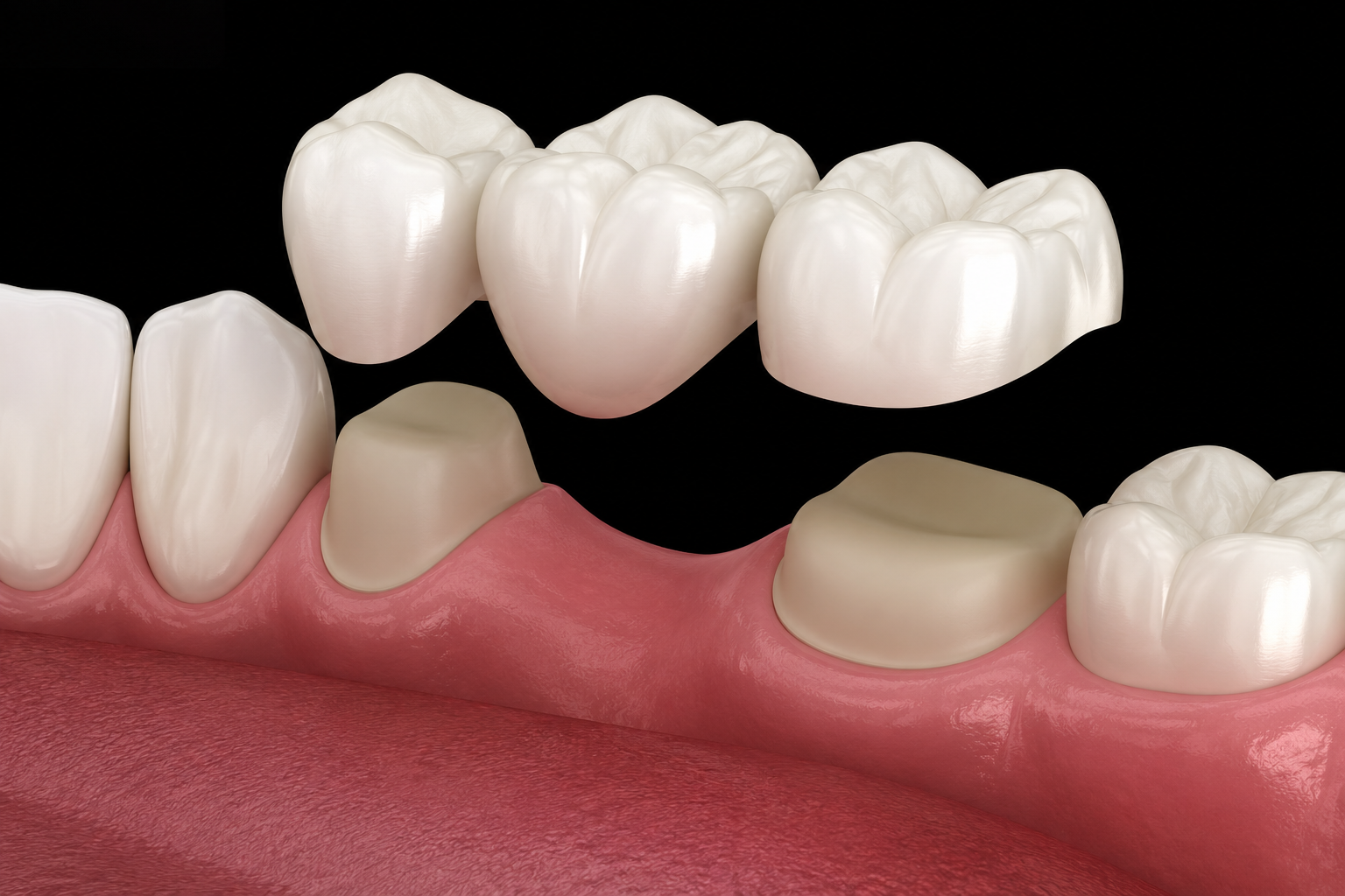 invisalign frequently asked questions